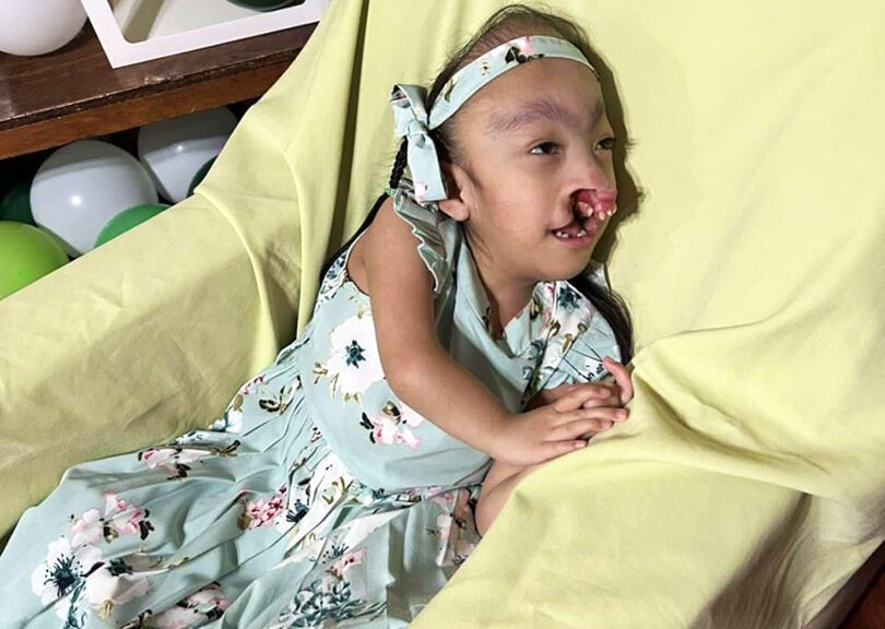 A girl with special needs lays on a padded chair